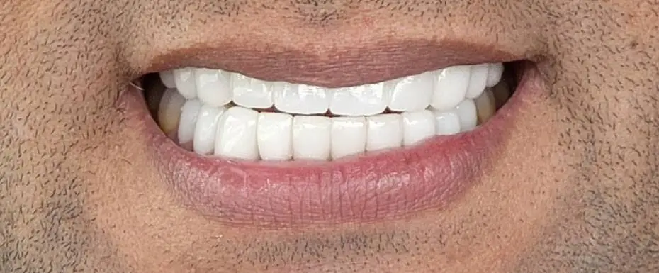Smile Dental Center Miami