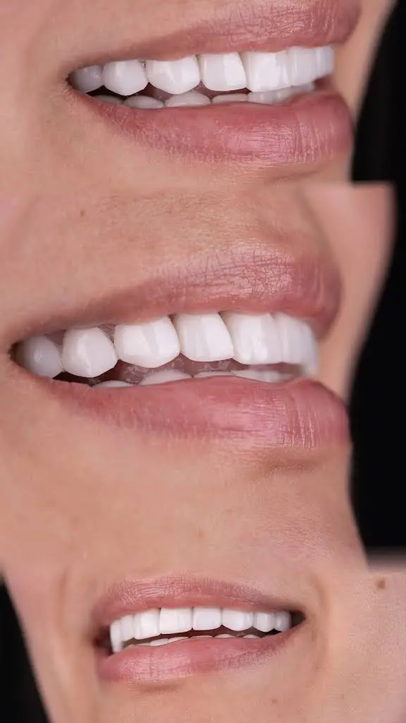 Smile Dental Center Miami