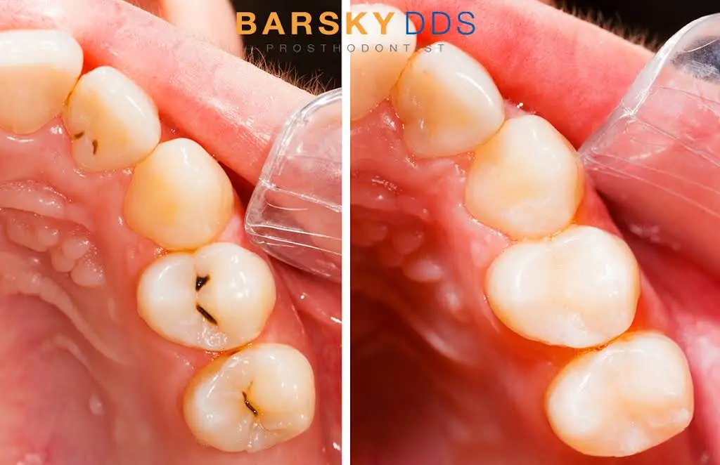 Todd Barsky DDS, FACP