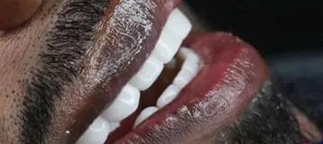Dental Design Smile