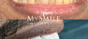 My Smile Center