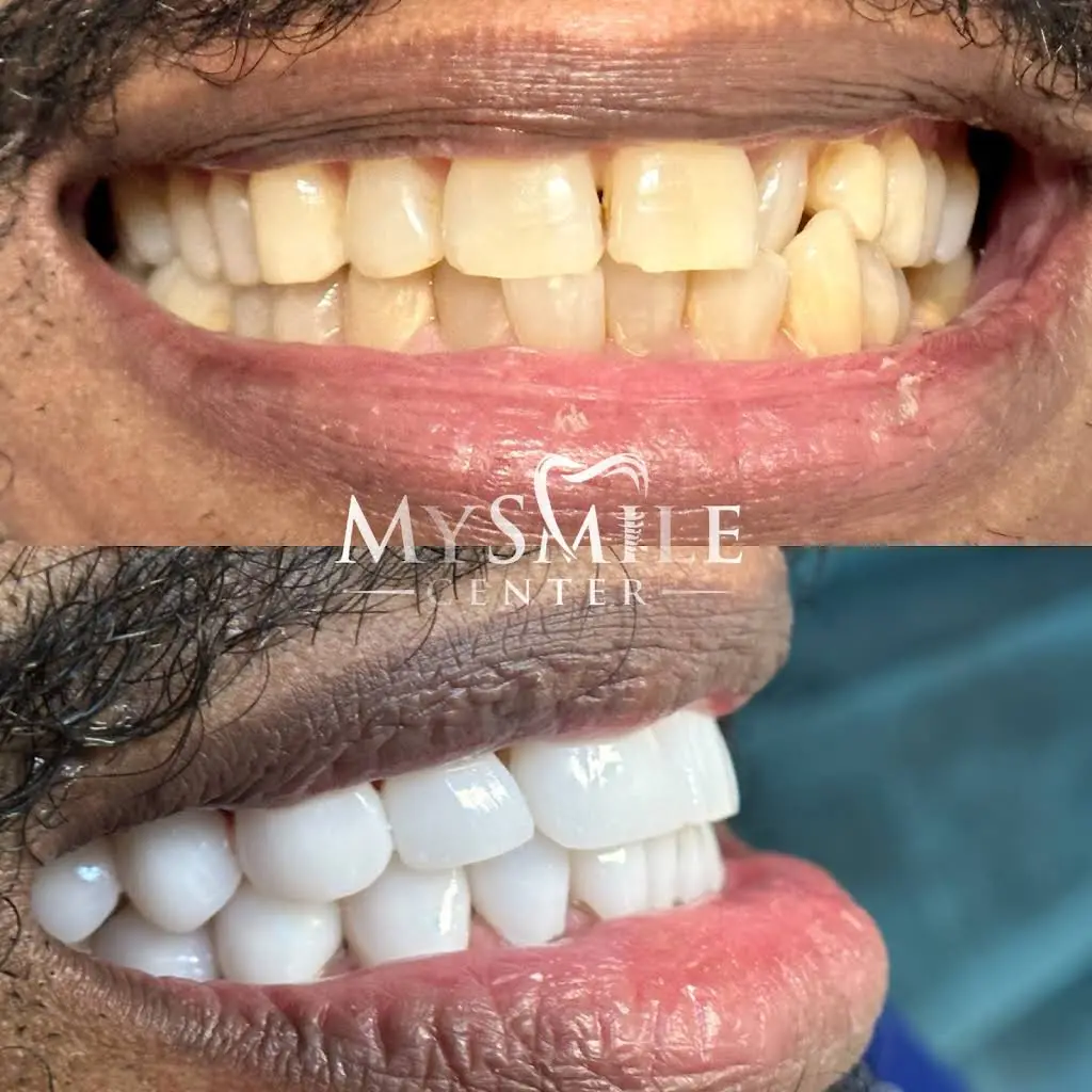 My Smile Center - Professional dental clinic exterior with modern facilities