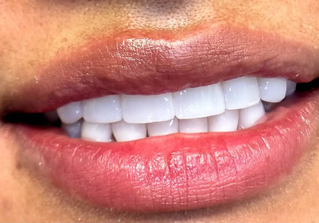 My Smile Center