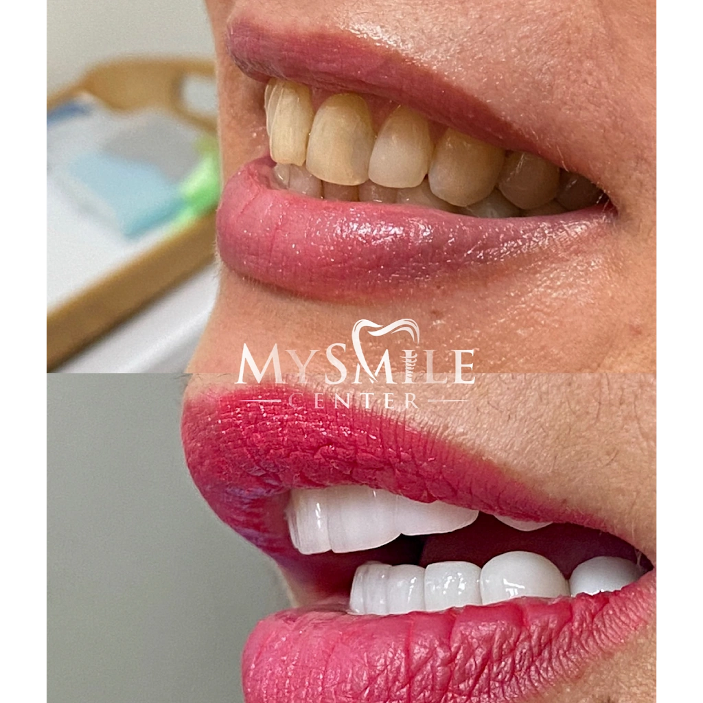 My Smile Center