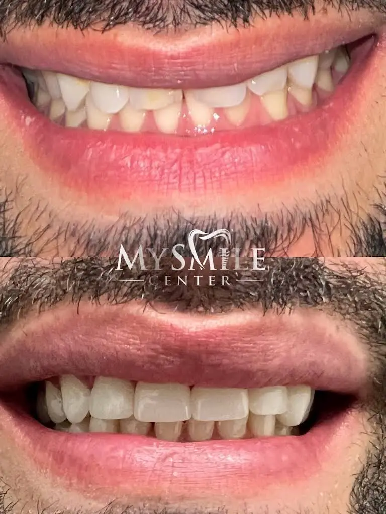 My Smile Center
