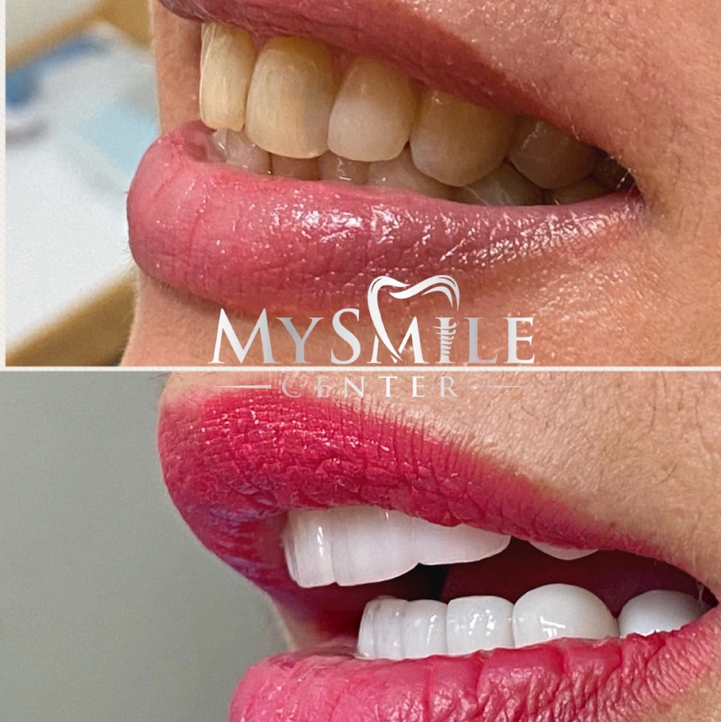 My Smile Center
