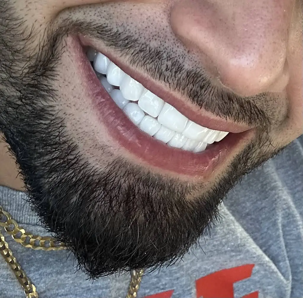 Dental Esthetic Miami