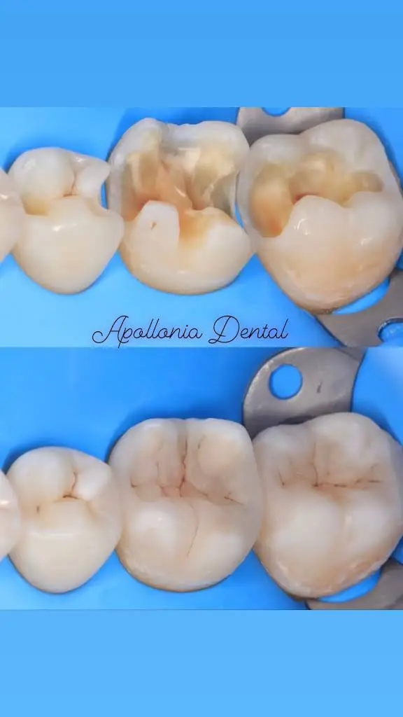 Apollonia Dental Services LLC