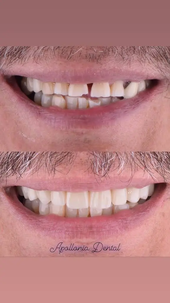 Apollonia Dental Services LLC