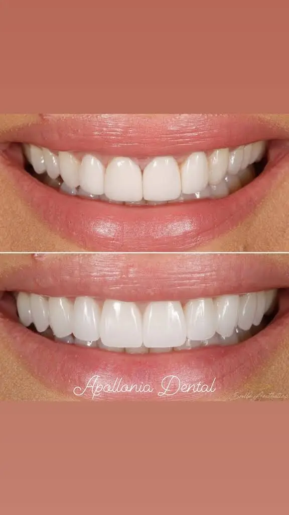 Apollonia Dental Services LLC