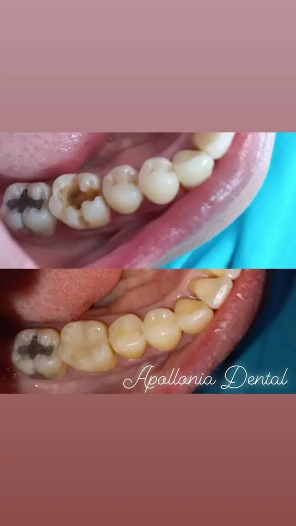 Apollonia Dental Services LLC