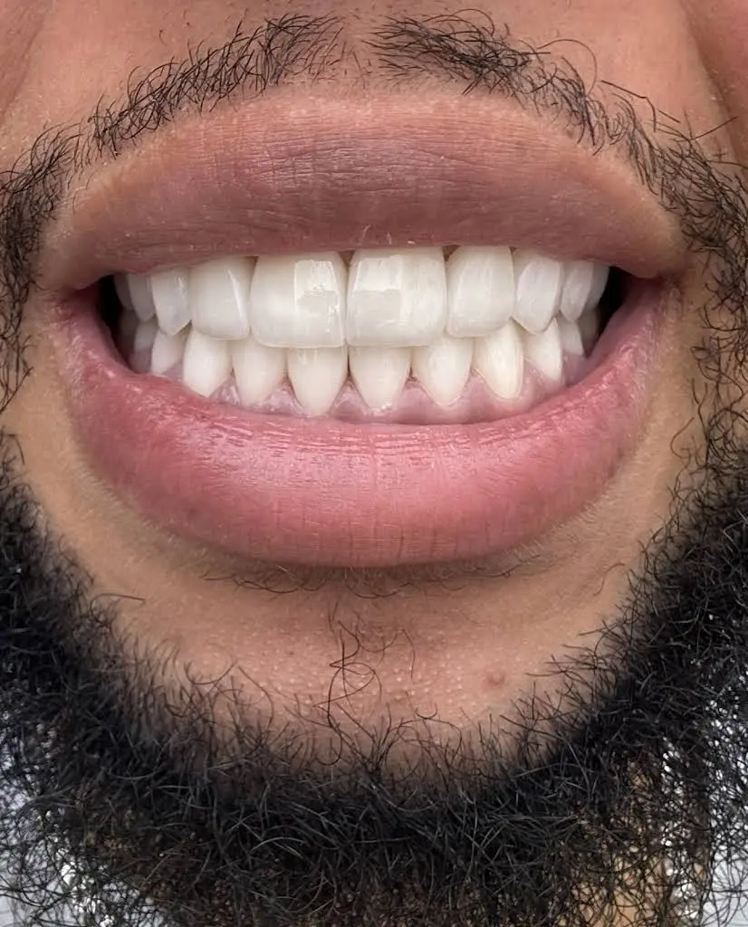 Moderna Dental