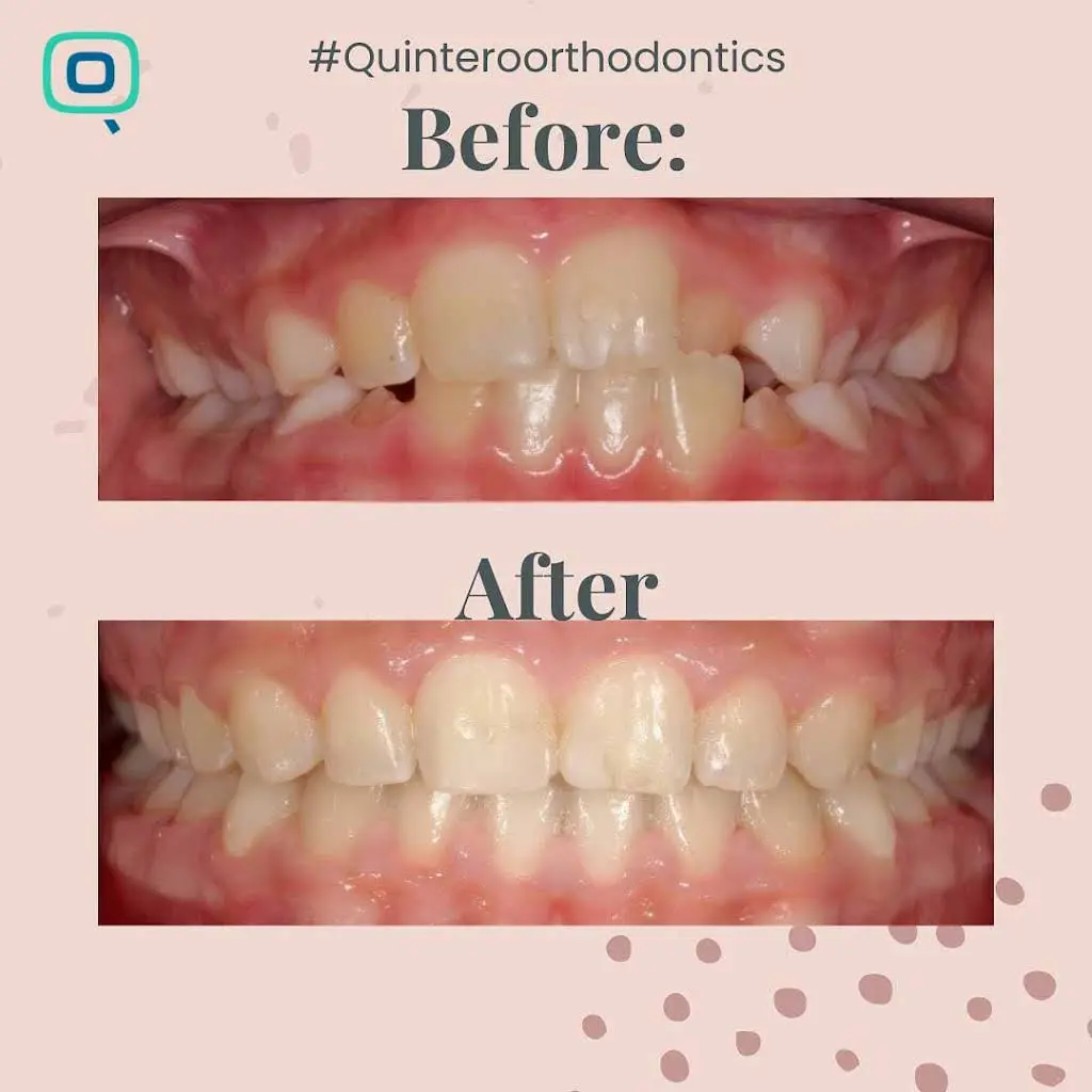 Quintero Orthodontics