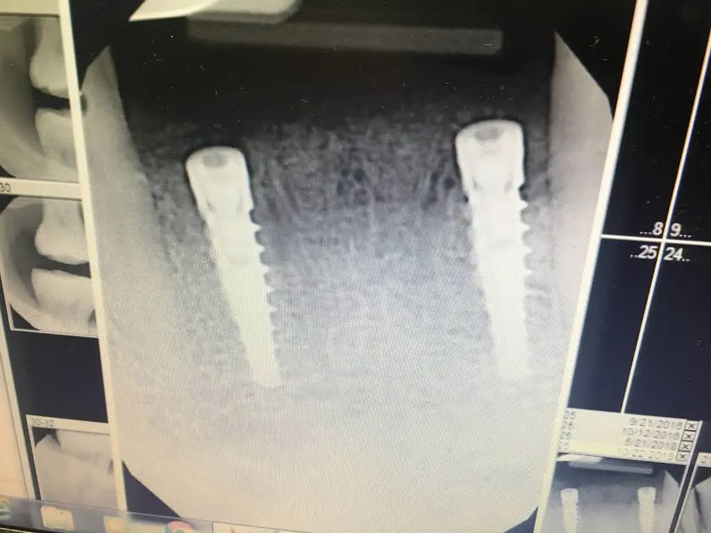 Miami Implant & Family Dentists