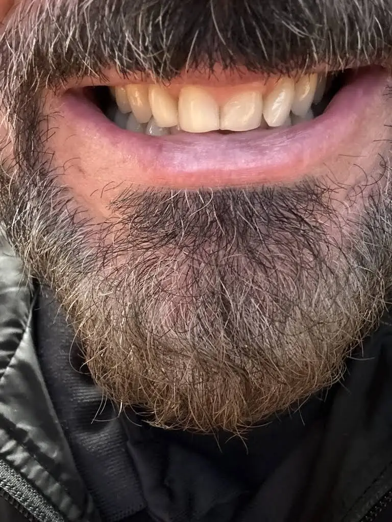 Miami Implant & Family Dentists