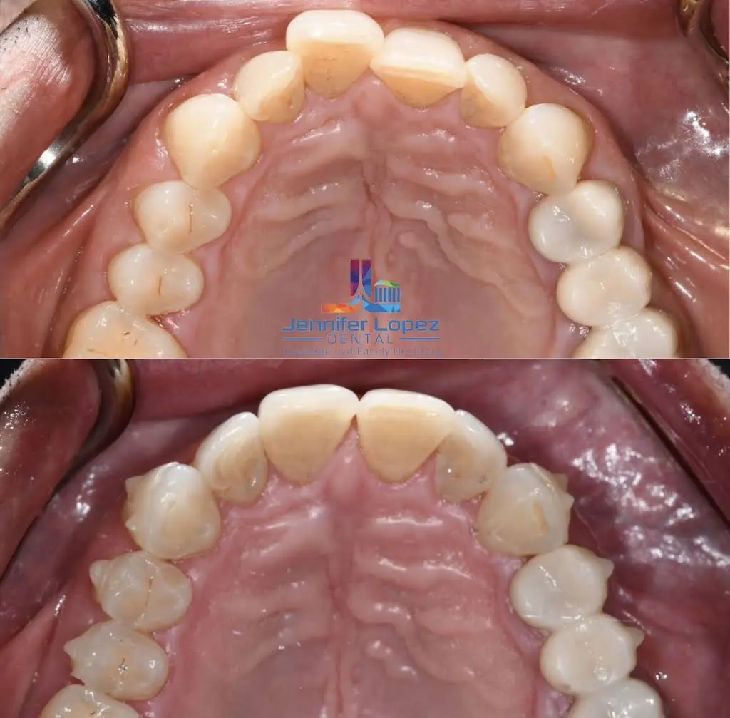 Jennifer Lopez Dental