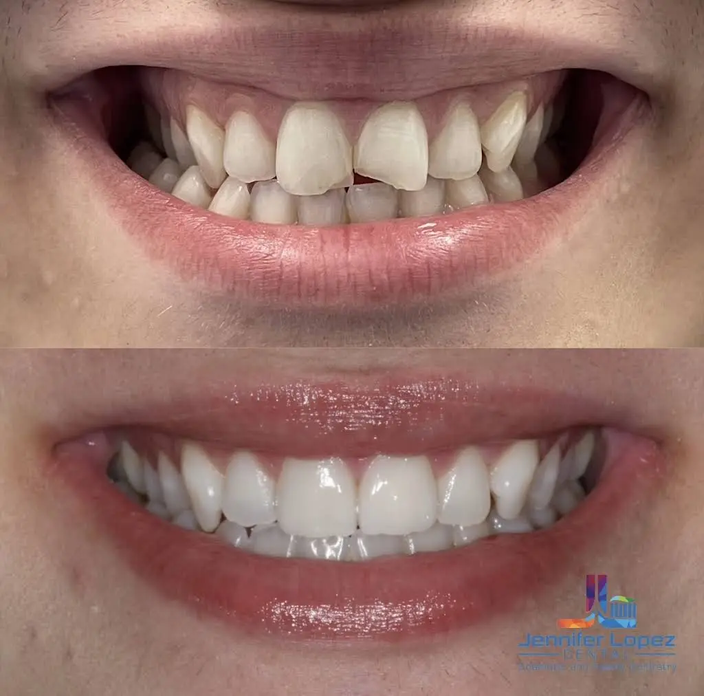 Jennifer Lopez Dental