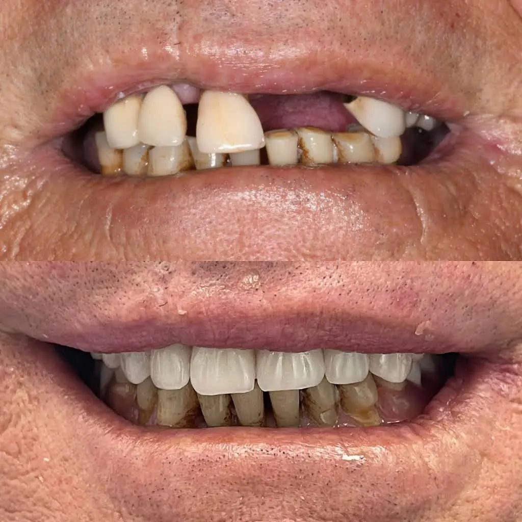 Jennifer Lopez Dental