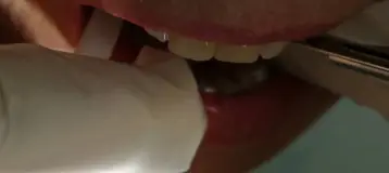 Sunset Center Dental Services