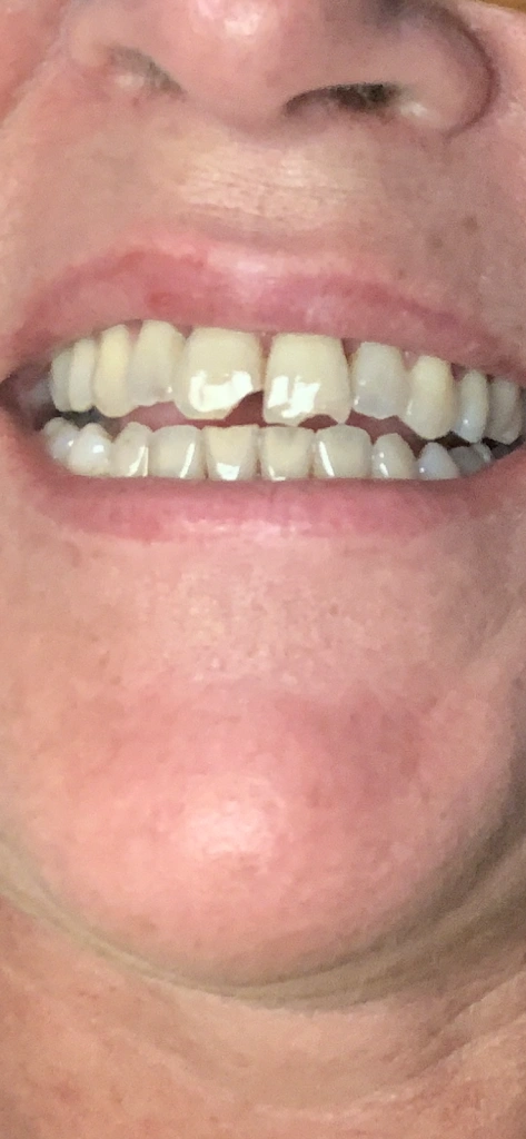 Galloway Dental Care
