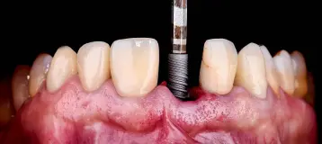 Perfect Smile Dental Centers