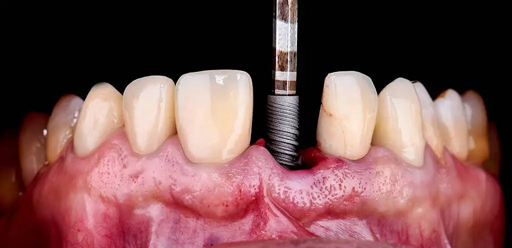Perfect Smile Dental Centers - Professional dental clinic exterior with modern facilities