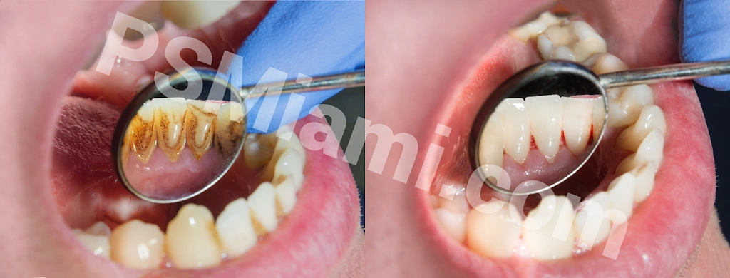 Perfect Smile Dental Centers