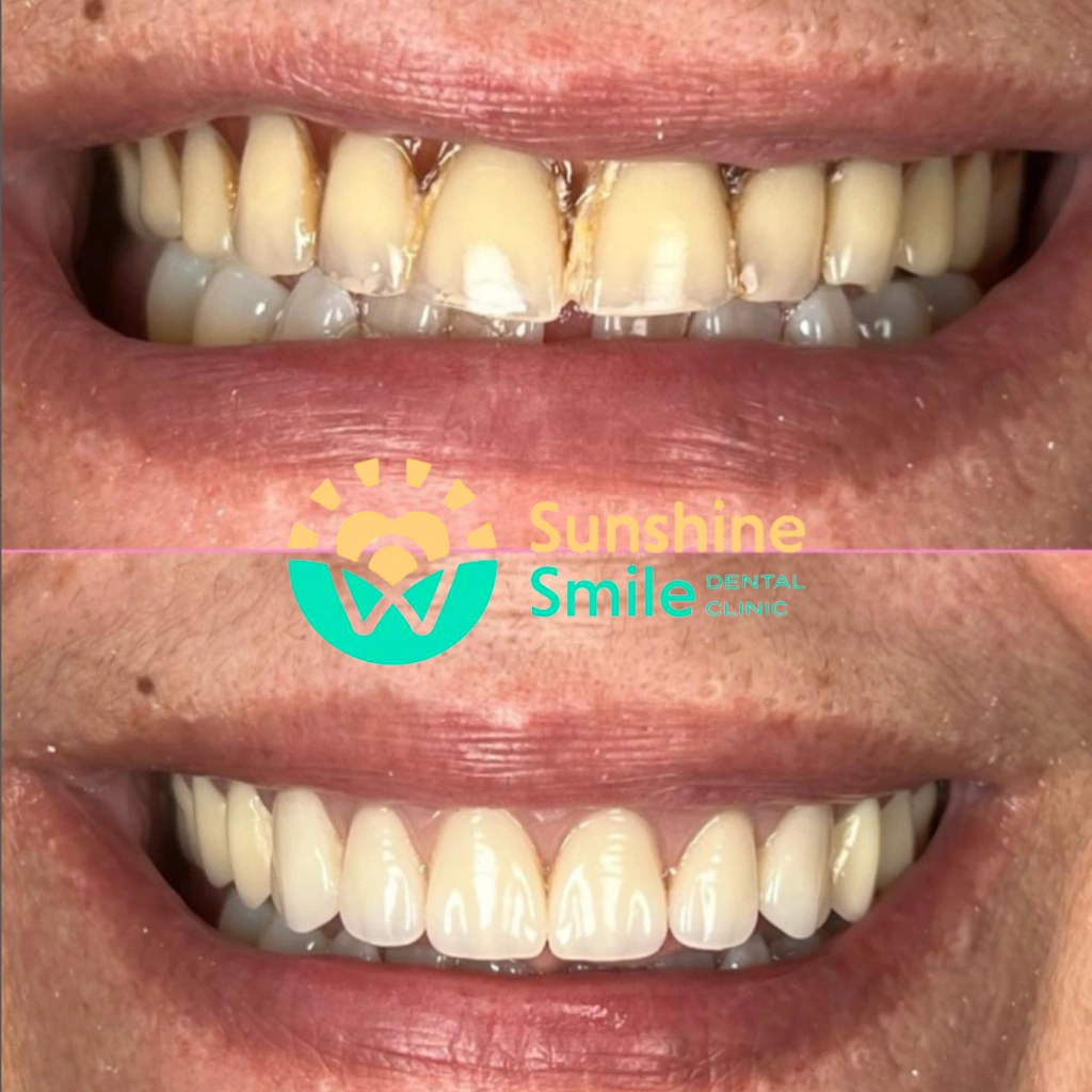 Sunshine Smiles Dental Clinic - Professional dental clinic exterior with modern facilities