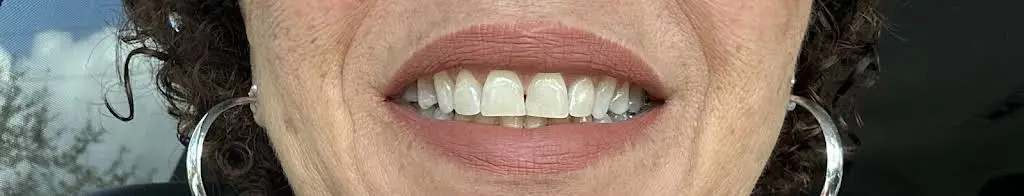 Advanced Center for Cosmetic and Implant Dentistry