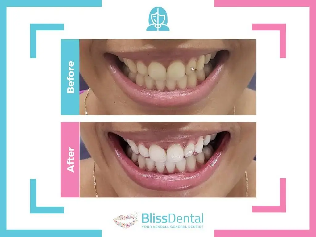 Bliss Dental