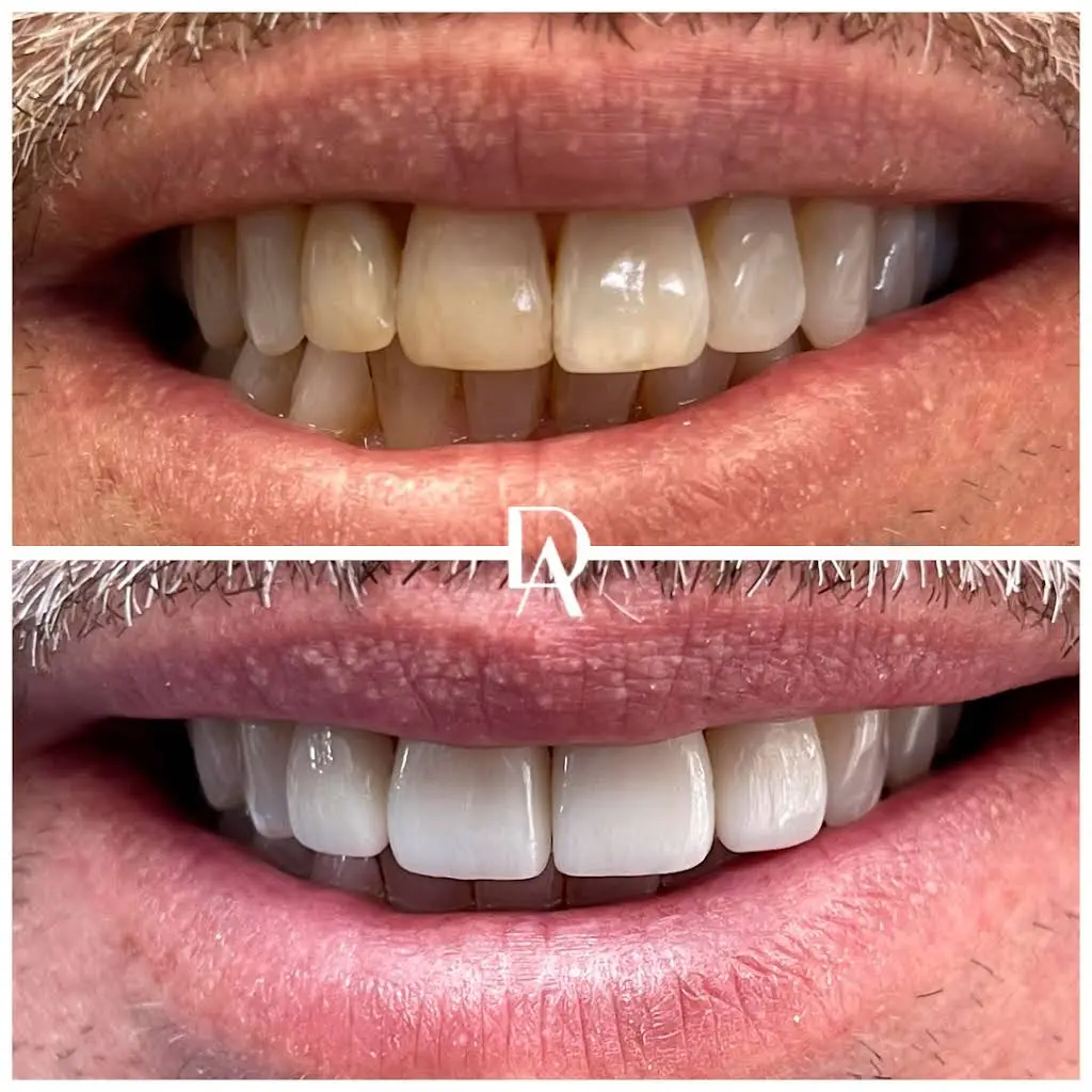 Dental Avenu Miami