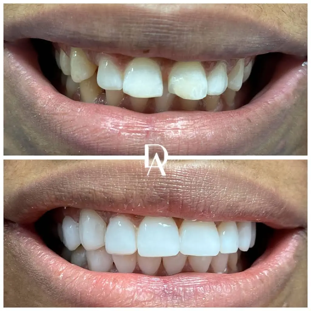 Dental Avenu Miami