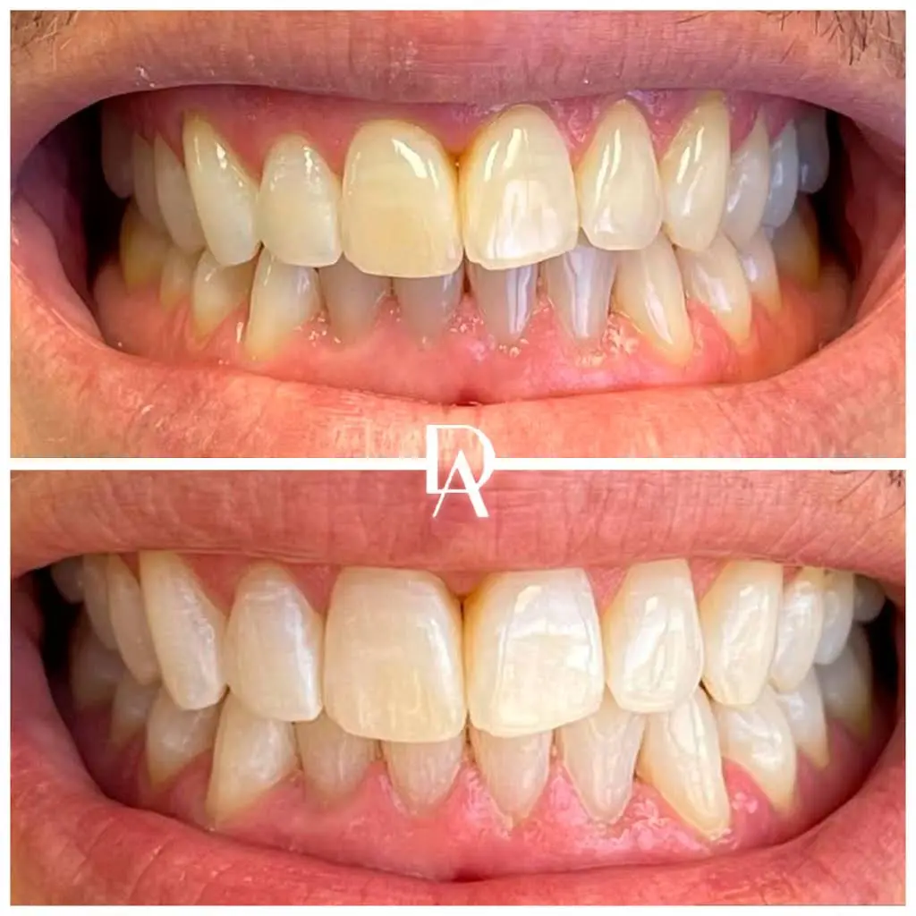 Dental Avenu Miami