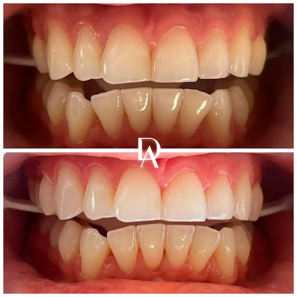Dental Avenu Miami