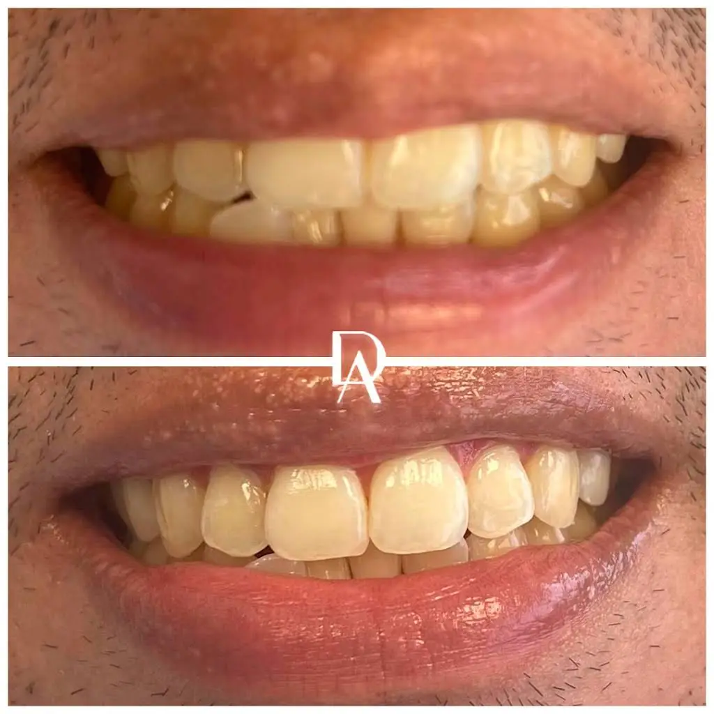 Dental Avenu Miami