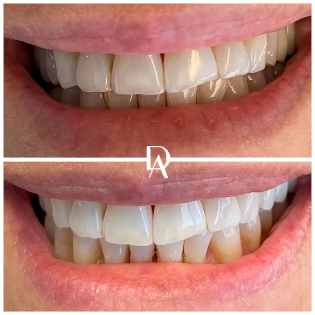 Dental Avenu Miami