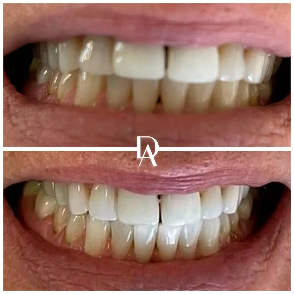 Dental Avenu Miami