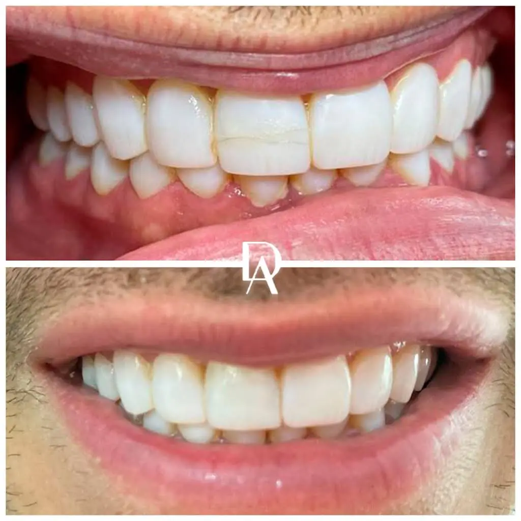 Dental Avenu Miami