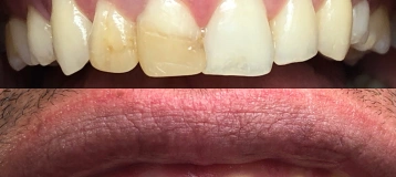 Dr Lopez Dental & Implant Center