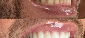 Batista Smile of Kendall