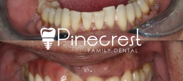 Pinecrest Family Dental