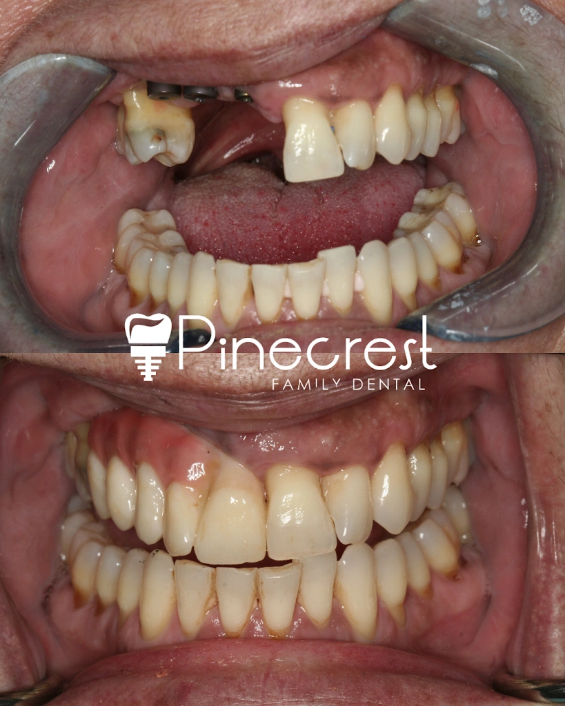 Pinecrest Family Dental - Professional dental clinic exterior with modern facilities