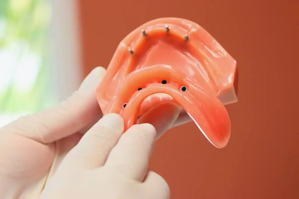 Pro Dental Centers - Kendall