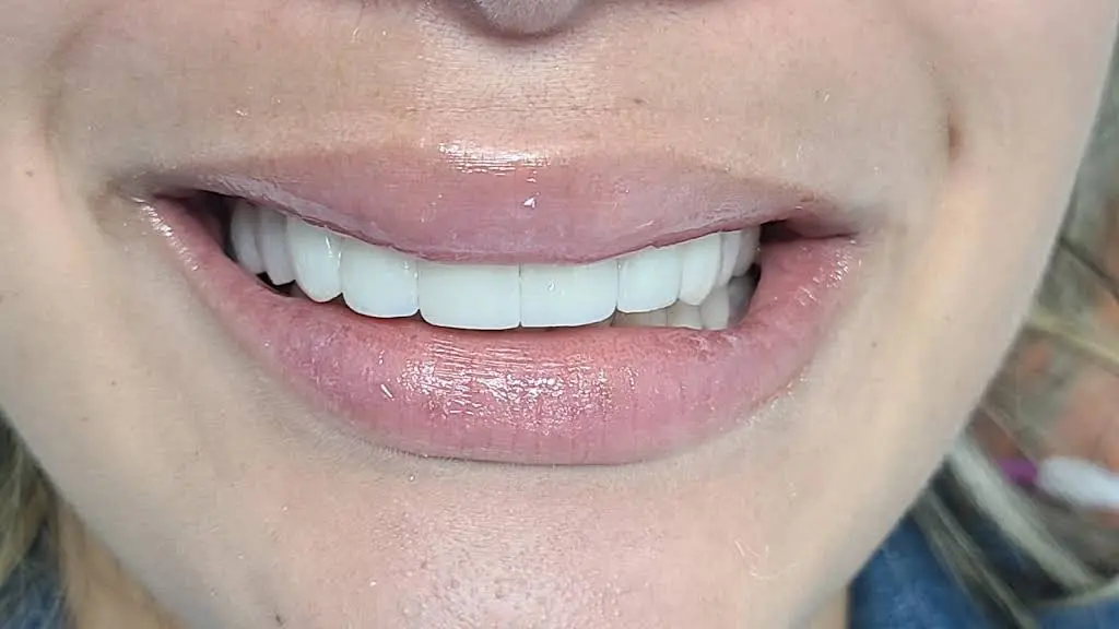 Smile Clear 3D