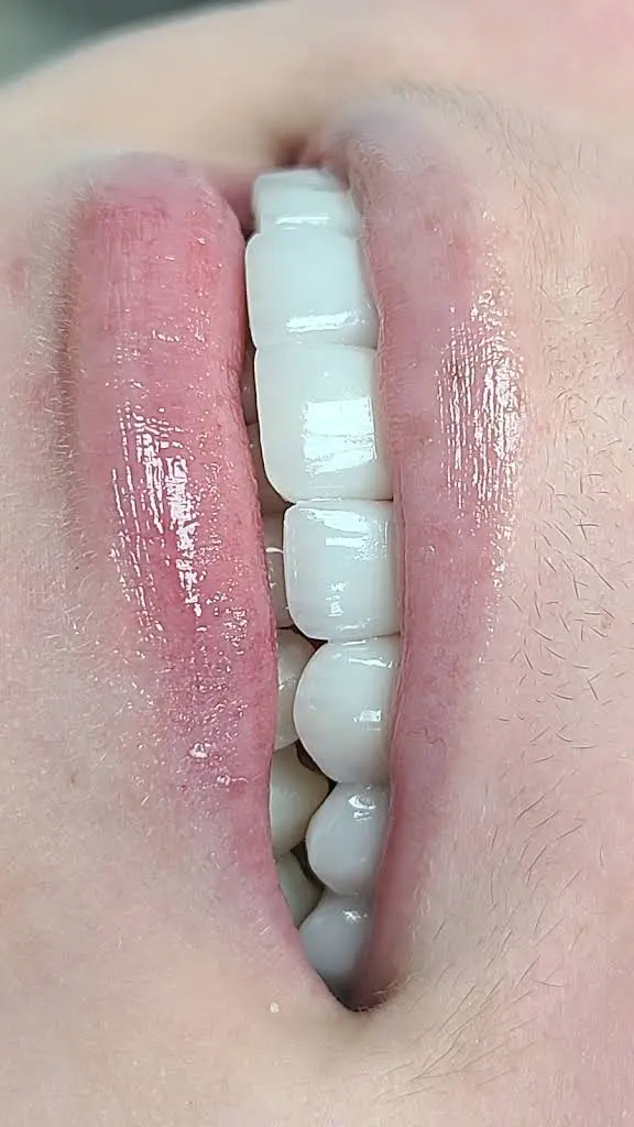 Smile Clear 3D