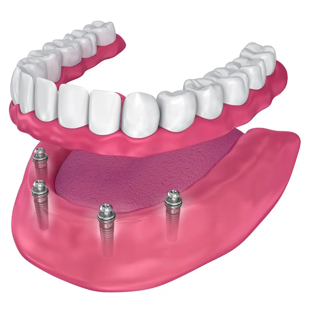 Best Value Dentures and Implants Palmetto Bay - Professional dental clinic exterior with modern facilities