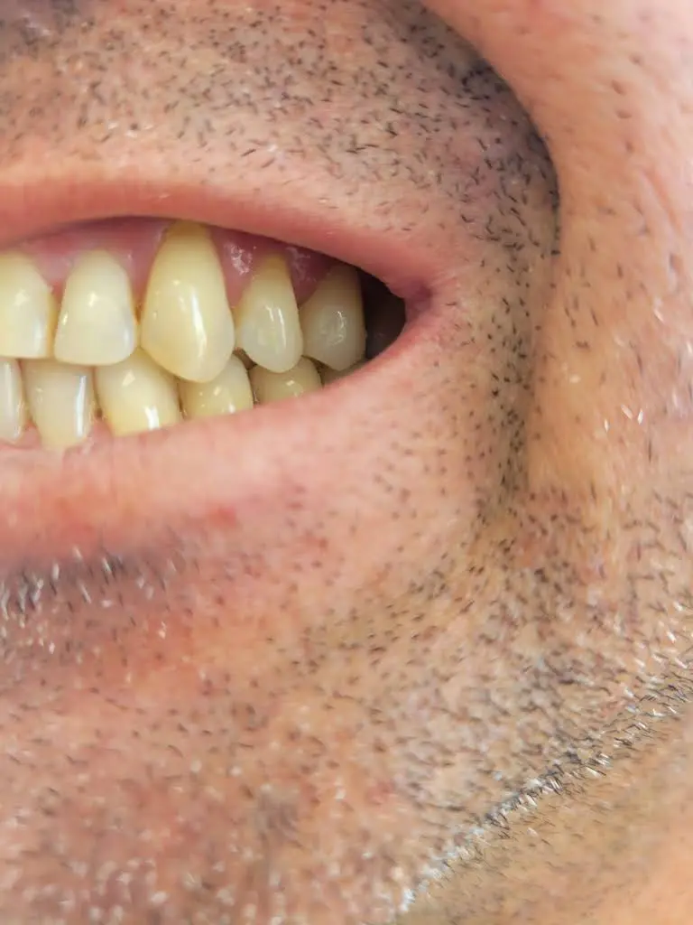 Valle Dental