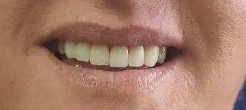 Family Plus Dental Centers