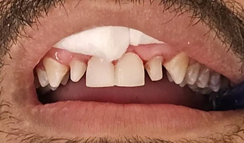 Health Dental of Homestead