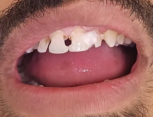 Health Dental of Homestead